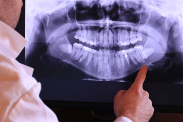 Best Emergency Dentist for Knocked-Out Tooth in Las Palmas Ii, TX